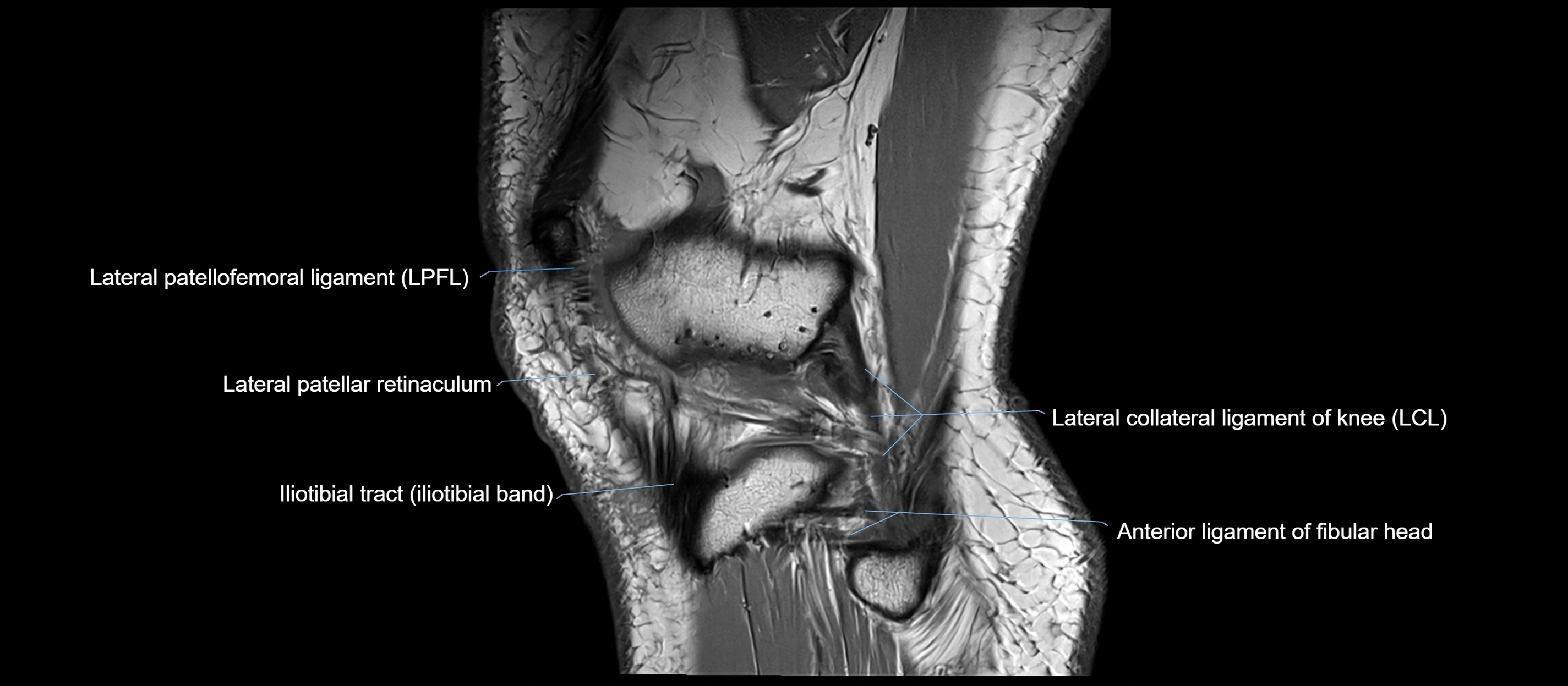 MRI sagittal  ligaments cross sectional anatomy 3T  radiology  image-img-00001-00041.webp